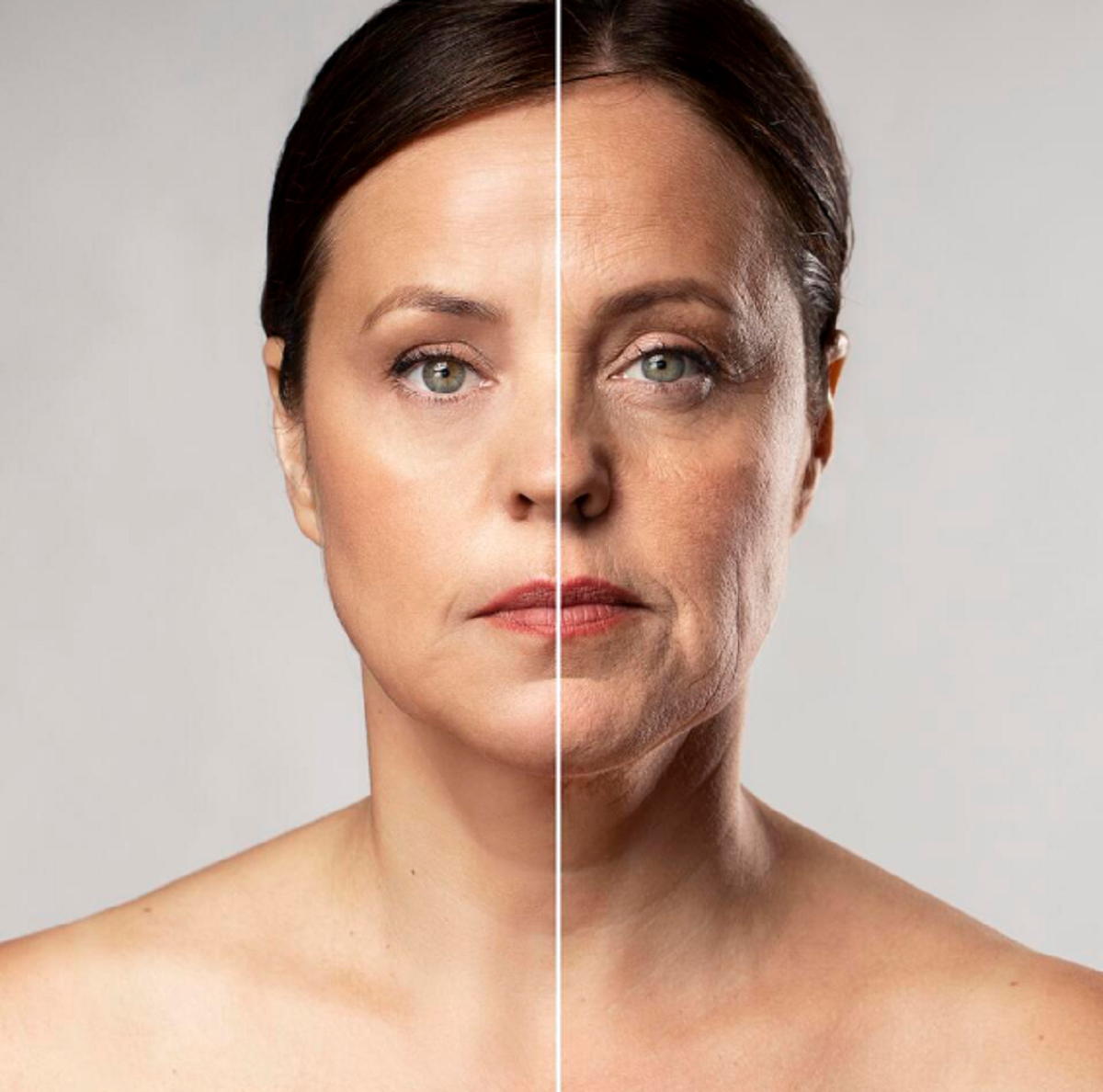 Quanto custa um facelift?